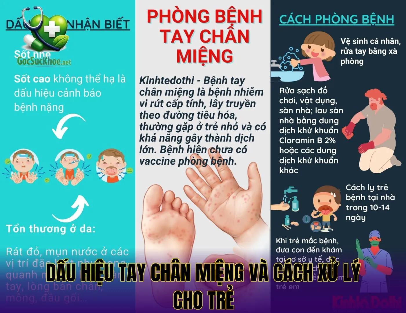 Dấu hiệu tay chân miệng và cách xử lý cho trẻ