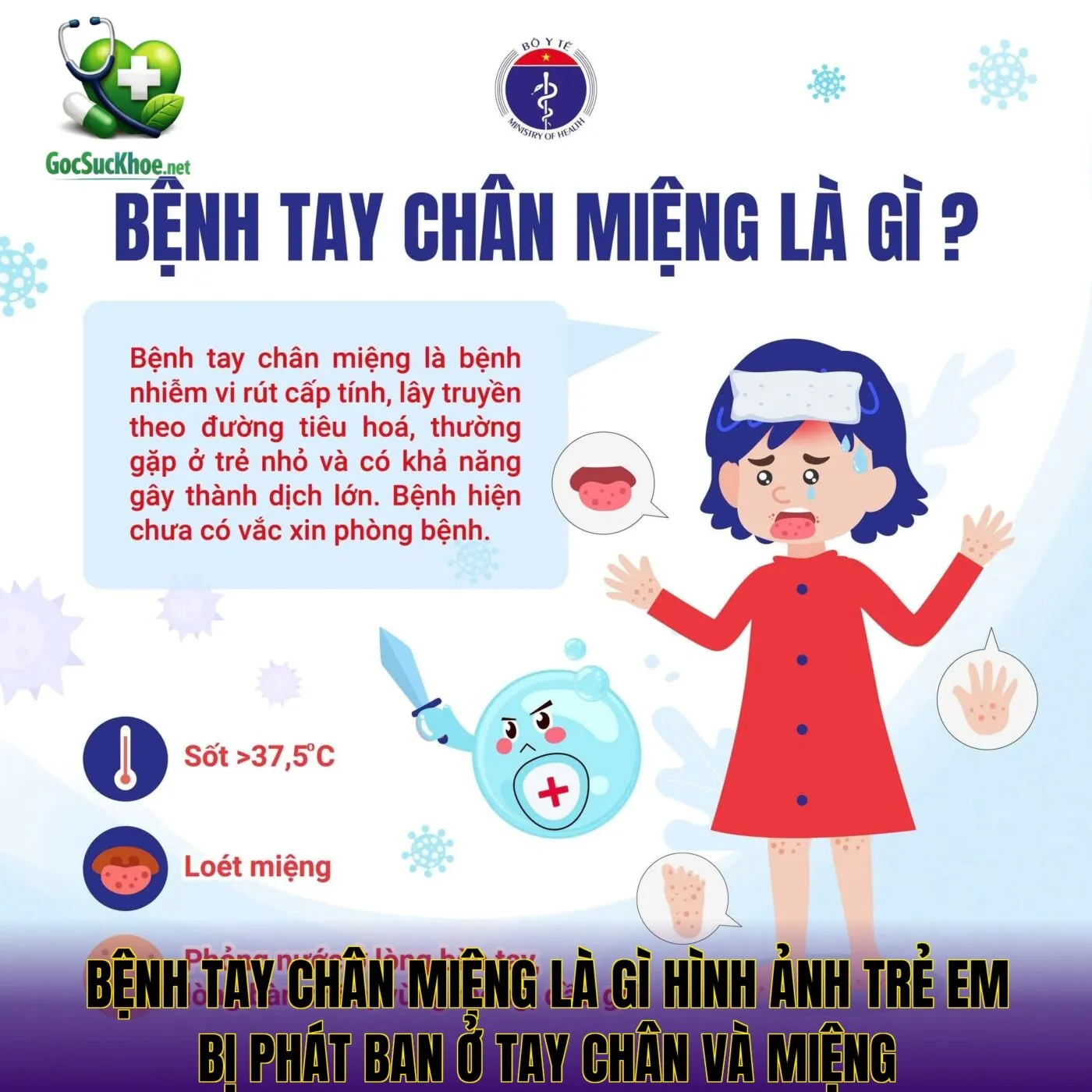 Bệnh tay chân miệng là gì hình ảnh trẻ em bị phát ban ở tay chân và miệng