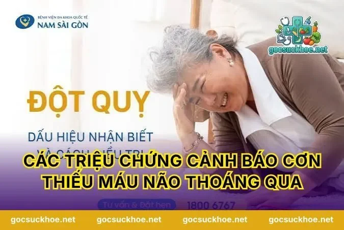 Các triệu chứng cảnh báo cơn thiếu máu não thoáng qua