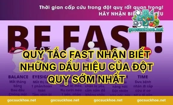 Quy tắc FAST nhận biết Những Dấu Hiệu Của Đột Quỵ sớm nhất